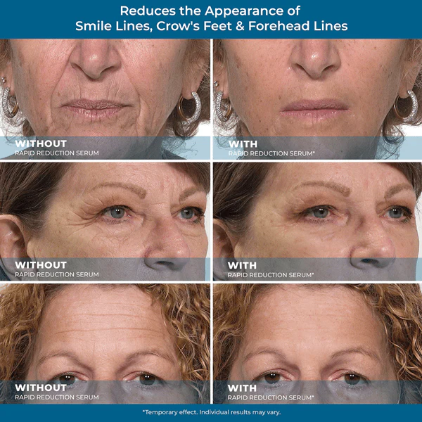 Plexaderm Rapid Reduction Advanced Formula Serum Pods Blister Pack (30x0.3mL) - Image 7