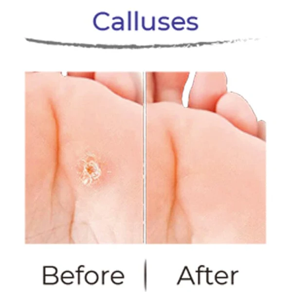 RevivaFoot Exfoliating Foot Peel Masks (2pk) | As Seen On Social! - Image 10