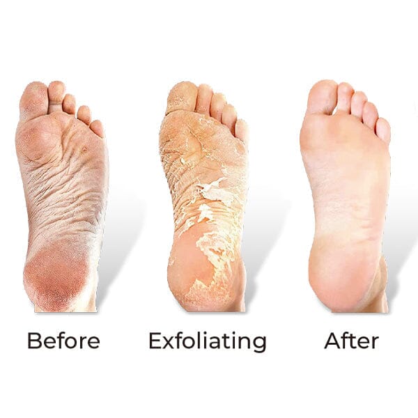 RevivaFoot Exfoliating Foot Peel Masks (2pk) | As Seen On Social! - Image 4
