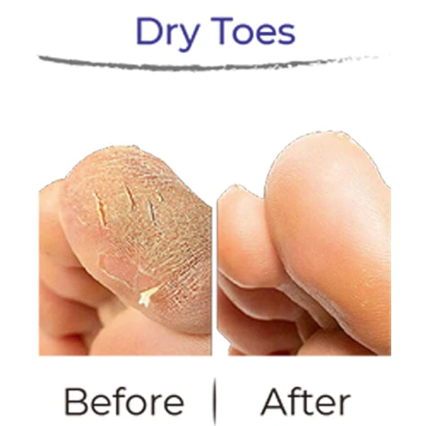 RevivaFoot Exfoliating Foot Peel Masks (2pk) | As Seen On Social! - Image 7