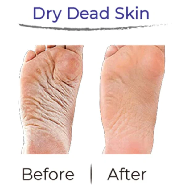RevivaFoot Exfoliating Foot Peel Masks (2pk) | As Seen On Social! - Image 8